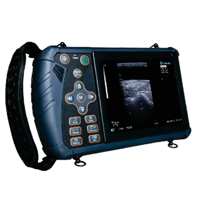 S1 Sistema de Diagnóstico por Ultrasonido